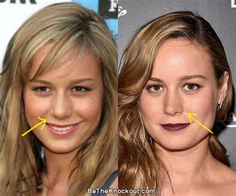 brie larson fakes|Brie Larson Plastic Surgery Comparison Photos